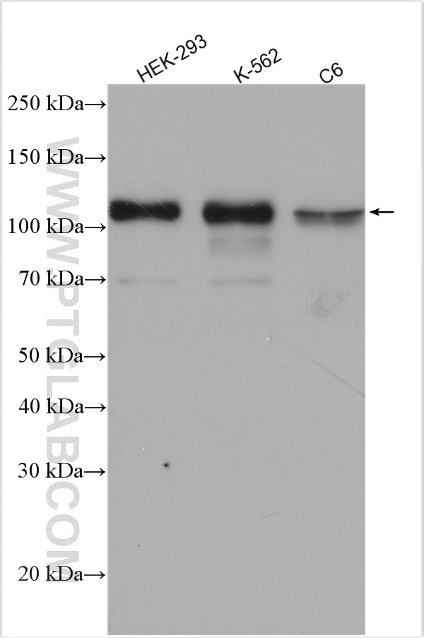 Western Blot (WB) analysis of various lysates using GAB1 Polyclonal antibody (26200-1-AP)