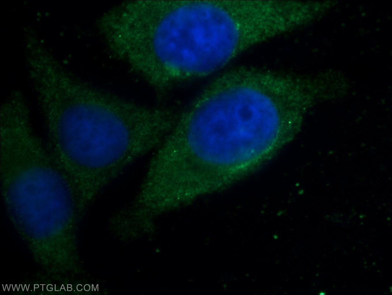 Immunofluorescence (IF) / fluorescent staining of HepG2 cells using GAB2 Polyclonal antibody (22549-1-AP)