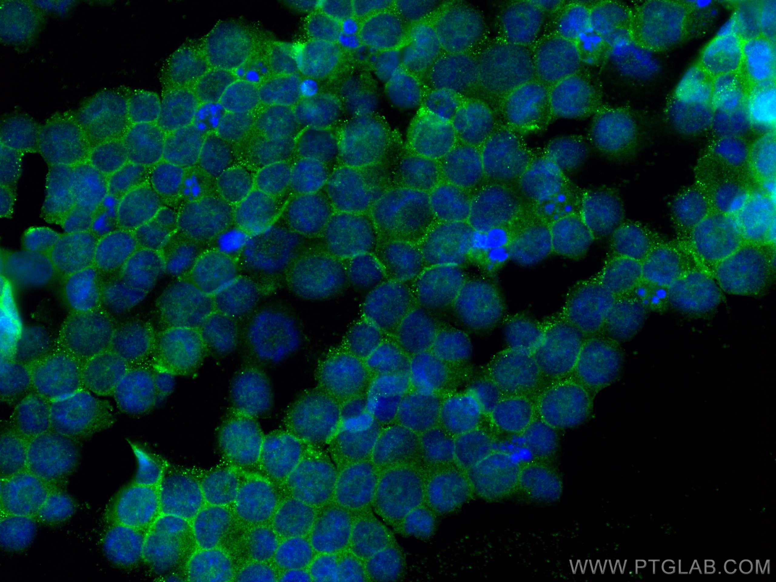 Immunofluorescence (IF) / fluorescent staining of K-562 cells using GAB2 Polyclonal antibody (22549-1-AP)