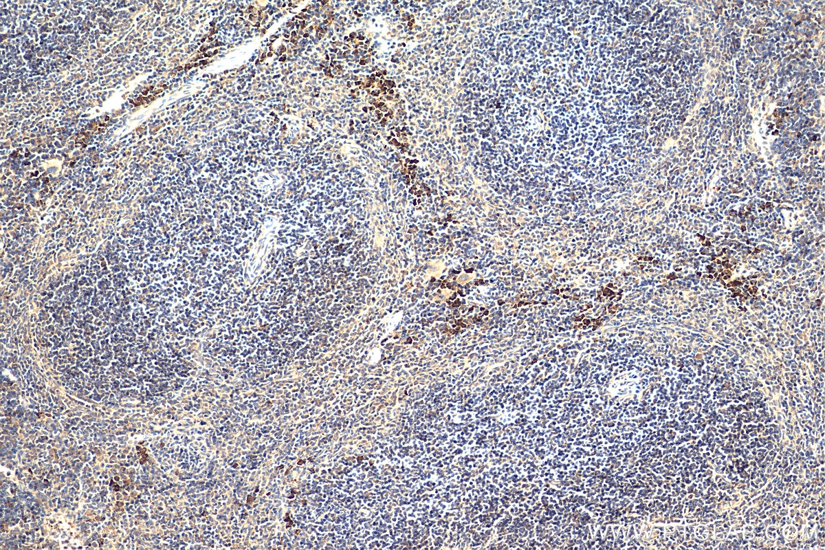 IHC staining of mouse spleen using 22549-1-AP
