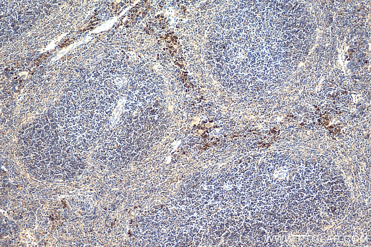 Immunohistochemistry (IHC) staining of mouse spleen tissue using GAB2 Polyclonal antibody (22549-1-AP)