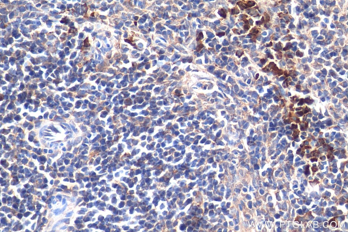 Immunohistochemistry (IHC) staining of mouse spleen tissue using GAB2 Polyclonal antibody (22549-1-AP)