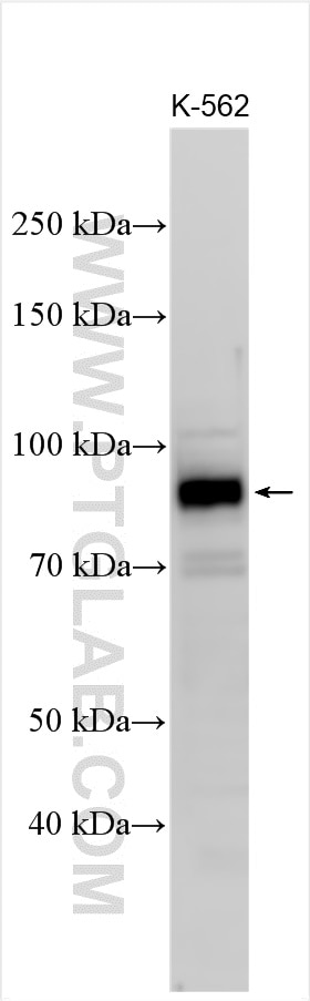 Western Blot (WB) analysis of various lysates using GAB2 Polyclonal antibody (22549-1-AP)