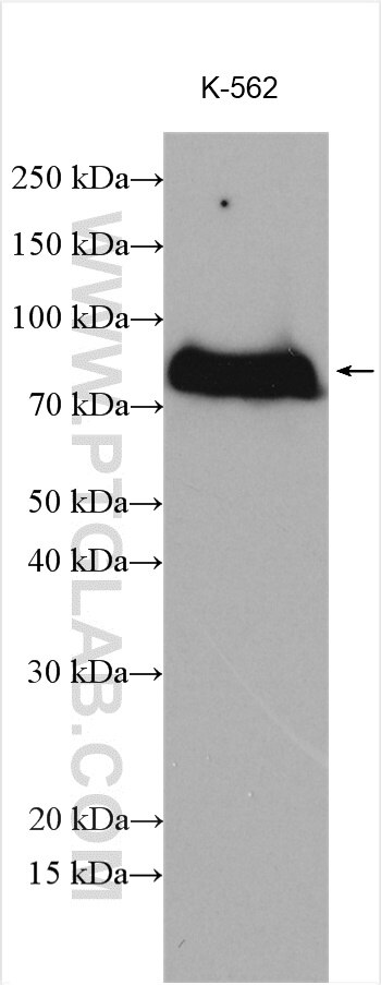 Western Blot (WB) analysis of various lysates using GAB2 Polyclonal antibody (29272-1-AP)