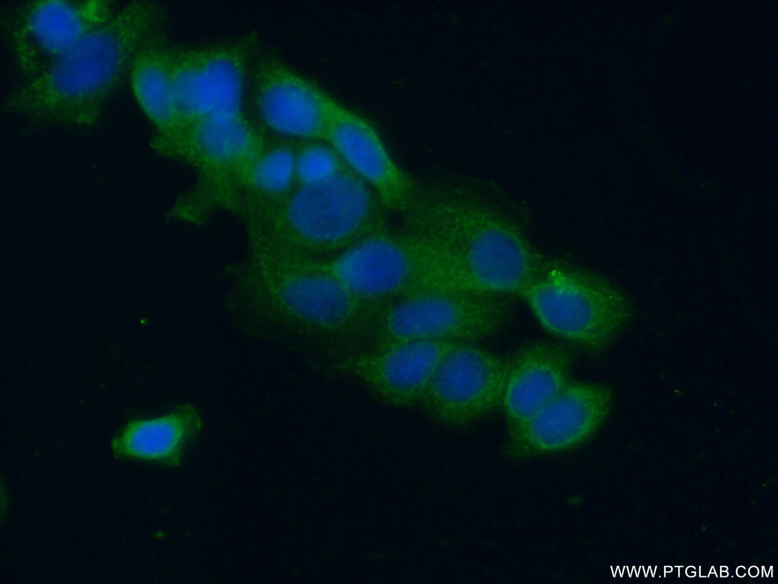 Immunofluorescence (IF) / fluorescent staining of MCF-7 cells using GAB3-Specific Polyclonal antibody (20089-1-AP)