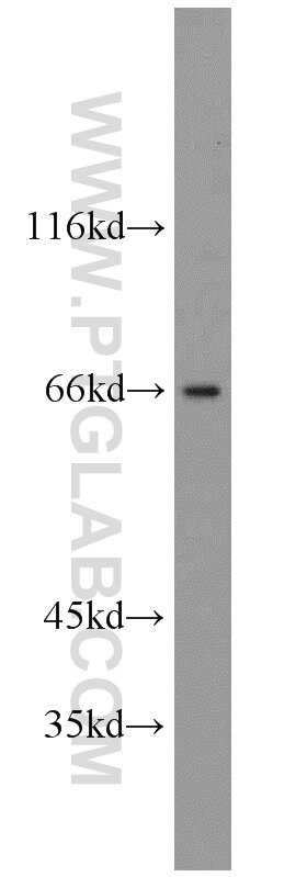 Western Blot (WB) analysis of HepG2 cells using GAB3-Specific Polyclonal antibody (20089-1-AP)