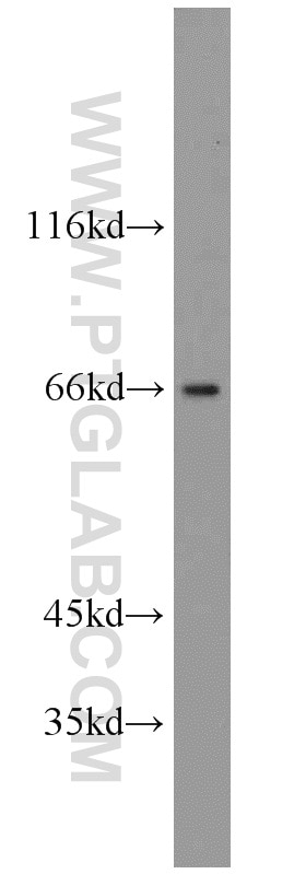 Western Blot (WB) analysis of HepG2 cells using GAB3-Specific Polyclonal antibody (20089-1-AP)