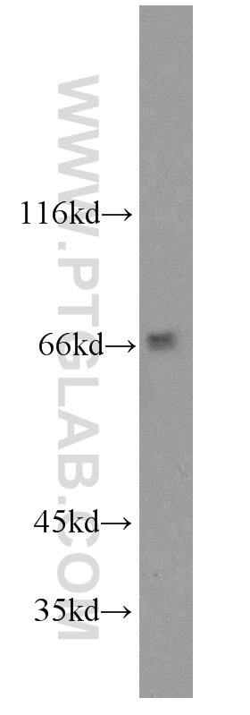 Western Blot (WB) analysis of MCF-7 cells using GAB3-Specific Polyclonal antibody (20089-1-AP)