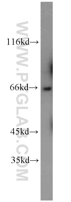 Western Blot (WB) analysis of mouse brain tissue using GAB3-Specific Polyclonal antibody (20089-1-AP)