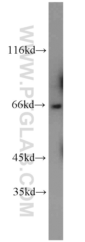 Western Blot (WB) analysis of mouse brain tissue using GAB3-Specific Polyclonal antibody (20089-1-AP)