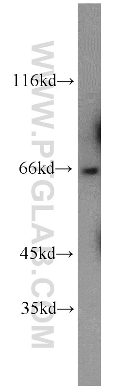 WB analysis of mouse brain using 20089-1-AP