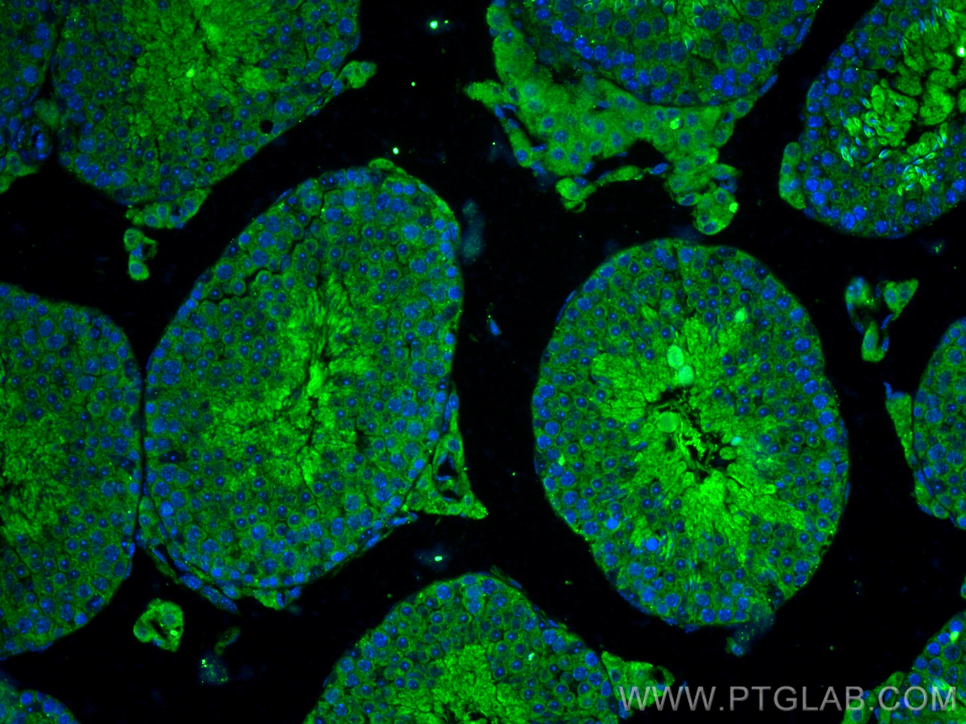 Immunofluorescence (IF) / fluorescent staining of mouse testis tissue using GAB4 Polyclonal antibody (20087-1-AP)