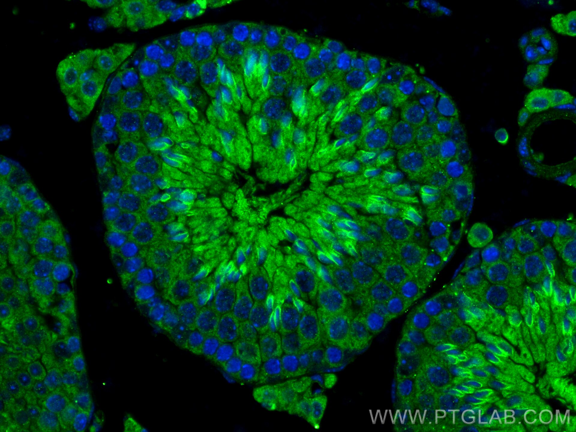 Immunofluorescence (IF) / fluorescent staining of mouse testis tissue using GAB4 Polyclonal antibody (20087-1-AP)
