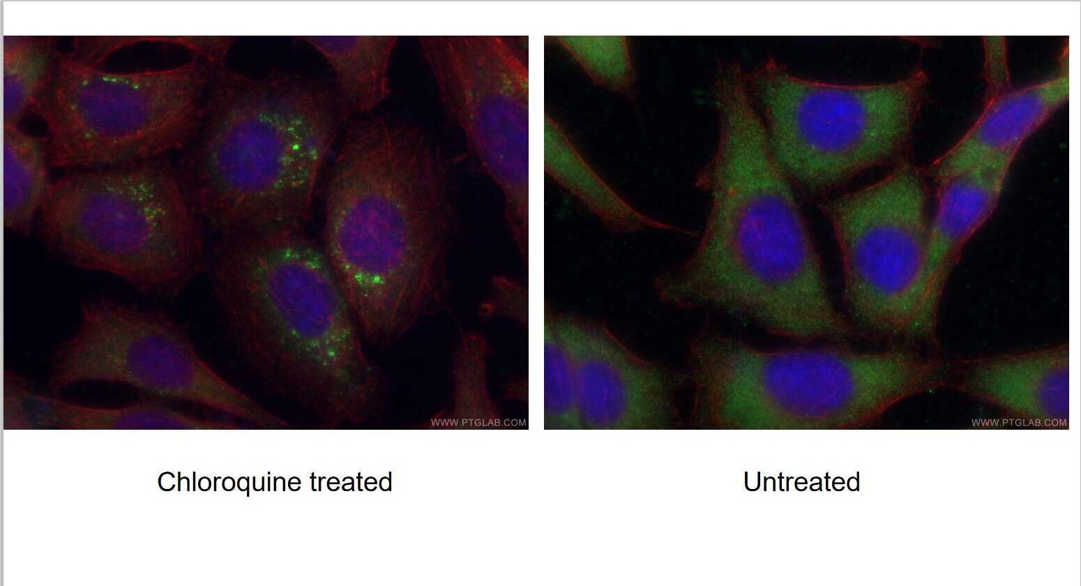 IF Staining of HepG2 using 18723-1-AP