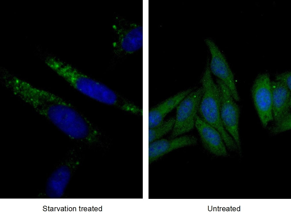 Immunofluorescence (IF) / fluorescent staining of HepG2 cells using GABARAP Polyclonal antibody (18723-1-AP)