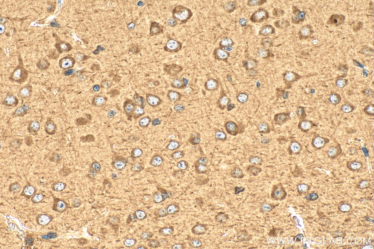 Immunohistochemistry (IHC) staining of mouse brain tissue using GABARAP Polyclonal antibody (18723-1-AP)