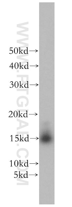 WB analysis of mouse brain using 18723-1-AP