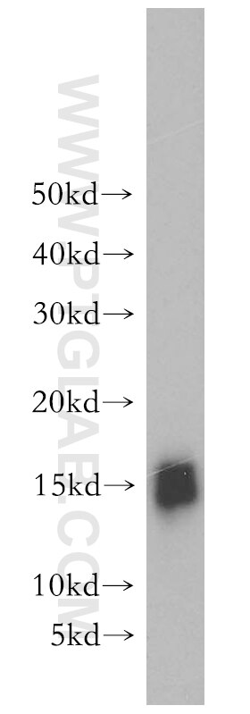 WB analysis of human placenta using 18723-1-AP