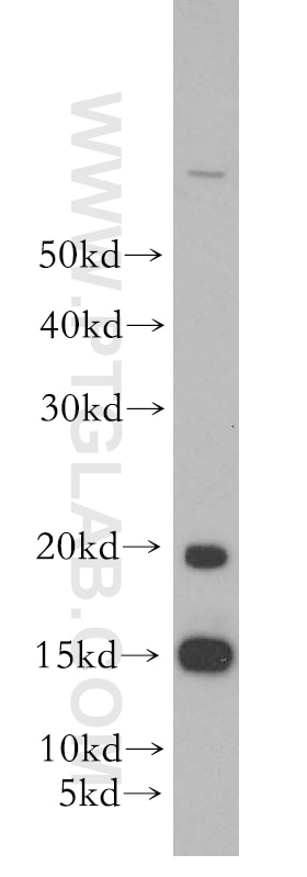 Western Blot (WB) analysis of human heart tissue using GABARAP Polyclonal antibody (18723-1-AP)