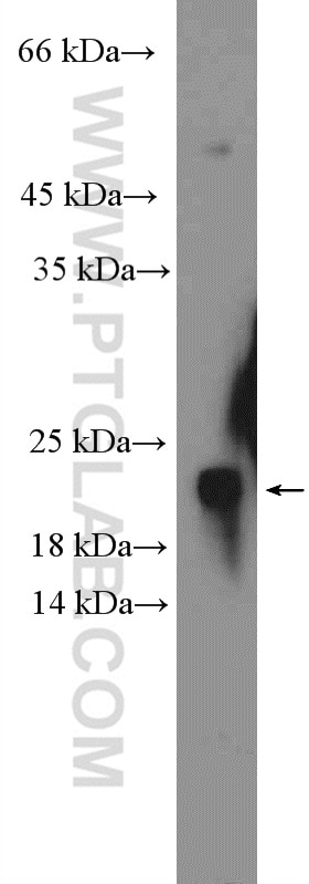 Western Blot (WB) analysis of mouse brain tissue using GABARAP Polyclonal antibody (22439-1-AP)