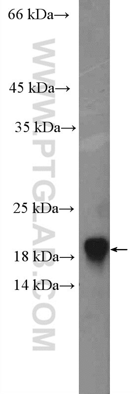 Western Blot (WB) analysis of HEK-293 cells using GABARAP Polyclonal antibody (22439-1-AP)