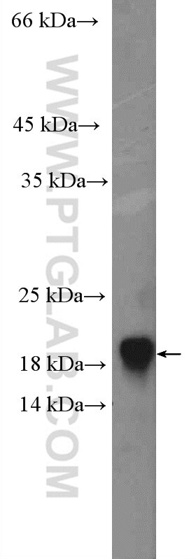 WB analysis of HEK-293 using 22439-1-AP