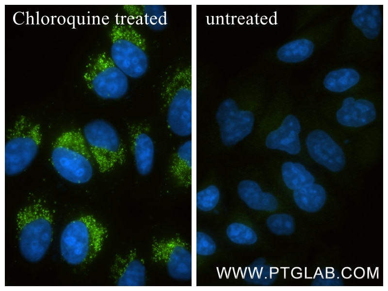 IF Staining of HepG2 using 86165-3-RR Immunofluorescence (IF) / fluorescent staining of HepG2 cells using GABARAP Recombinant monoclonal antibody (86165-3-RR)