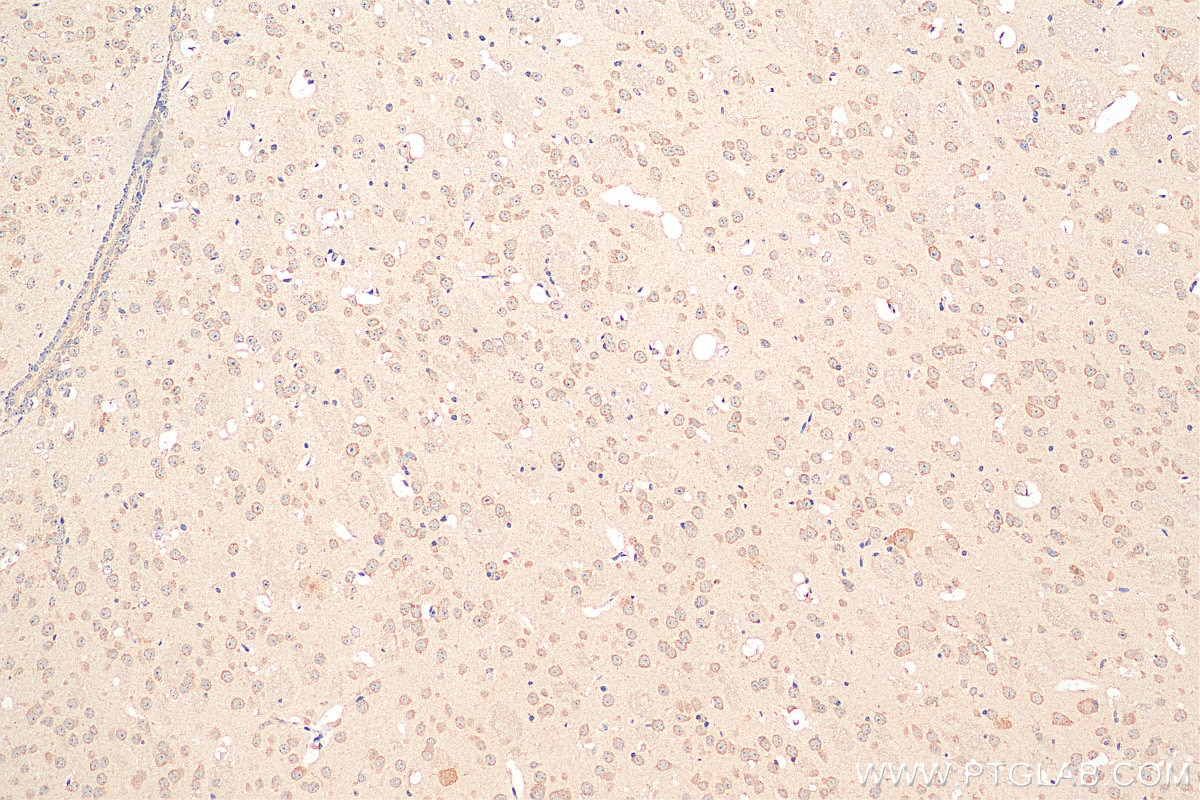 Immunohistochemistry (IHC) staining of mouse brain tissue using GABARAPL1 Polyclonal antibody (18721-1-AP)