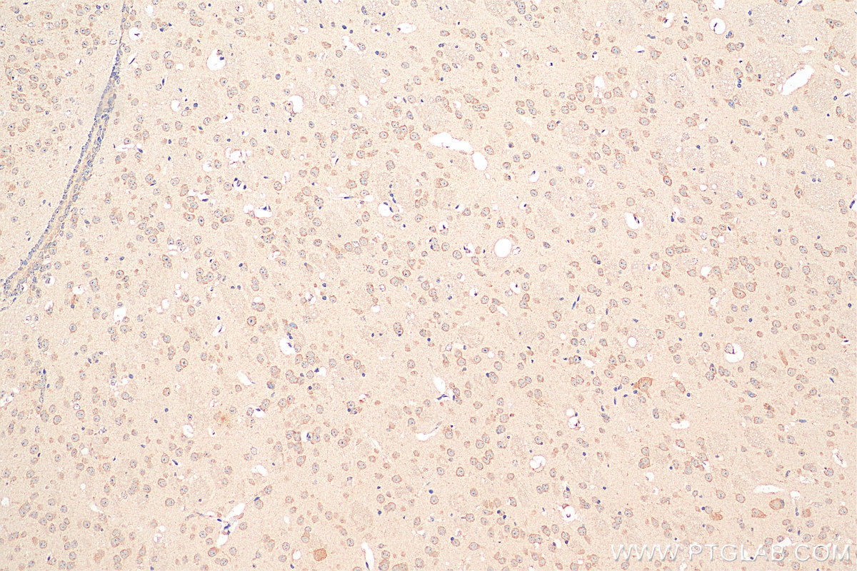 Immunohistochemistry (IHC) staining of mouse brain tissue using GABARAPL1-Specific Polyclonal antibody (18721-1-AP)