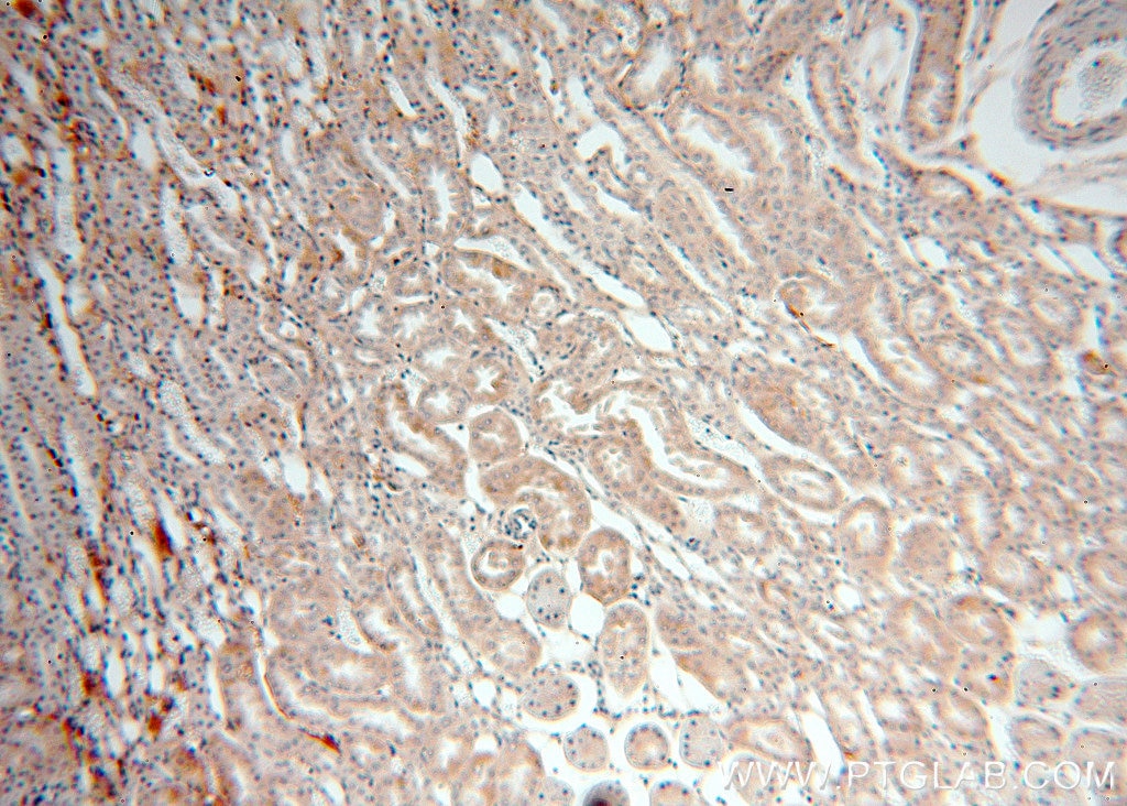 Immunohistochemistry (IHC) staining of human kidney tissue using GABARAPL1-Specific Polyclonal antibody (18721-1-AP)