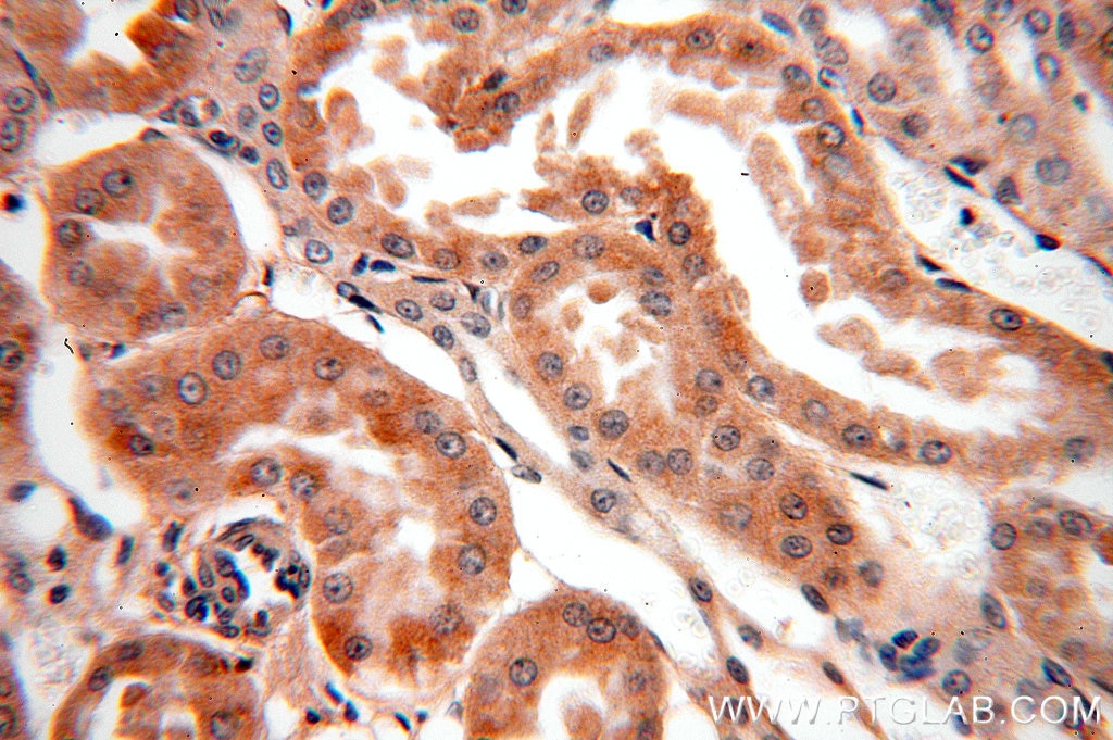 Immunohistochemistry (IHC) staining of human kidney tissue using GABARAPL1 Polyclonal antibody (18721-1-AP)