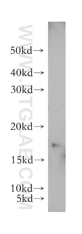 Western Blot (WB) analysis of human heart tissue using GABARAPL1-Specific Polyclonal antibody (18721-1-AP)