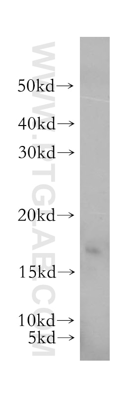 Western Blot (WB) analysis of human spleen tissue using GABARAPL1-Specific Polyclonal antibody (18721-1-AP)