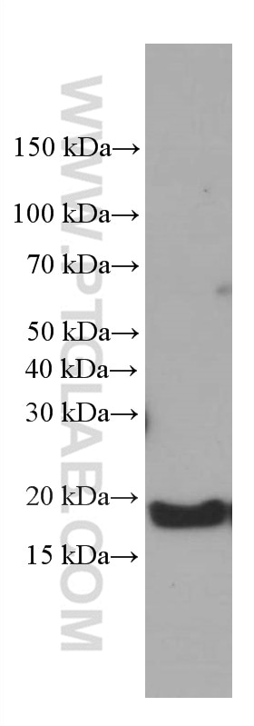 Western Blot (WB) analysis of rat brain tissue using GABARAPL1 Monoclonal antibody (66458-1-Ig)