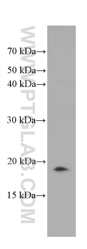 WB analysis of pig brain using 66458-1-Ig