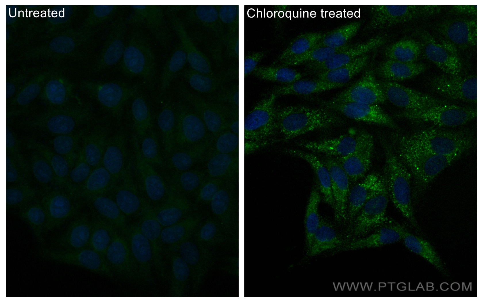 Immunofluorescence (IF) / fluorescent staining of HepG2 cells using CoraLite® Plus 488-conjugated GABARAPL1 Recombinan (CL488-83817)