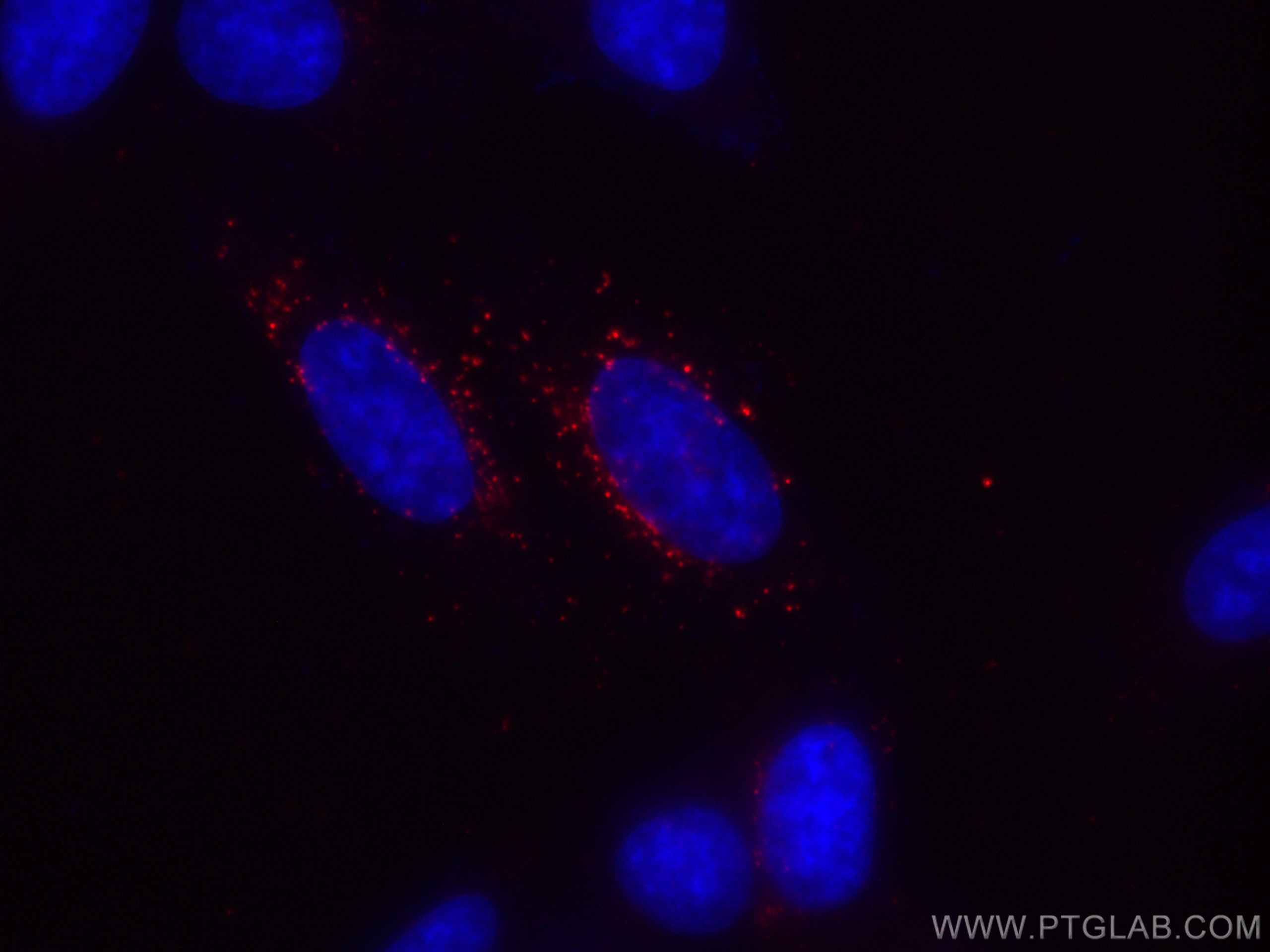 Immunofluorescence (IF) / fluorescent staining of HepG2 cells using CoraLite®594-conjugated GABARAPL1 Monoclonal antib (CL594-66458)