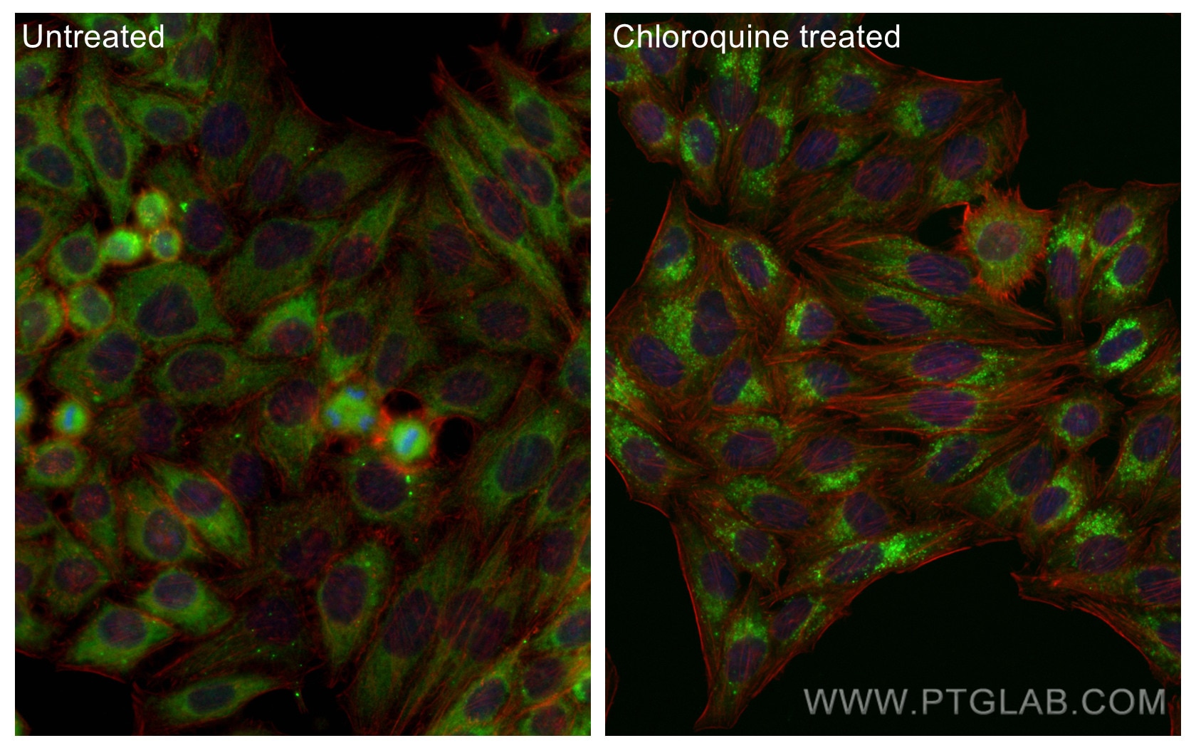 Immunofluorescence (IF) / fluorescent staining of HepG2 cells using CoraLite® Plus 488-conjugated GABARAPL1-Specific P (CL488-11010)