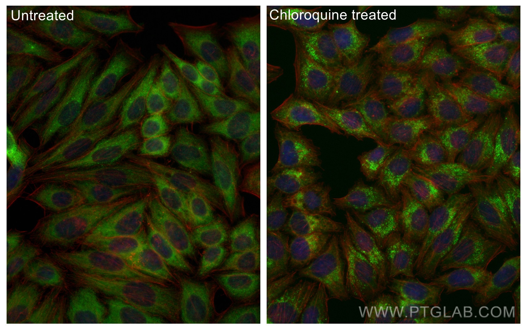 Immunofluorescence (IF) / fluorescent staining of HepG2 cells using CoraLite® Plus 488-conjugated GABARAPL1-Specific P (CL488-11010)