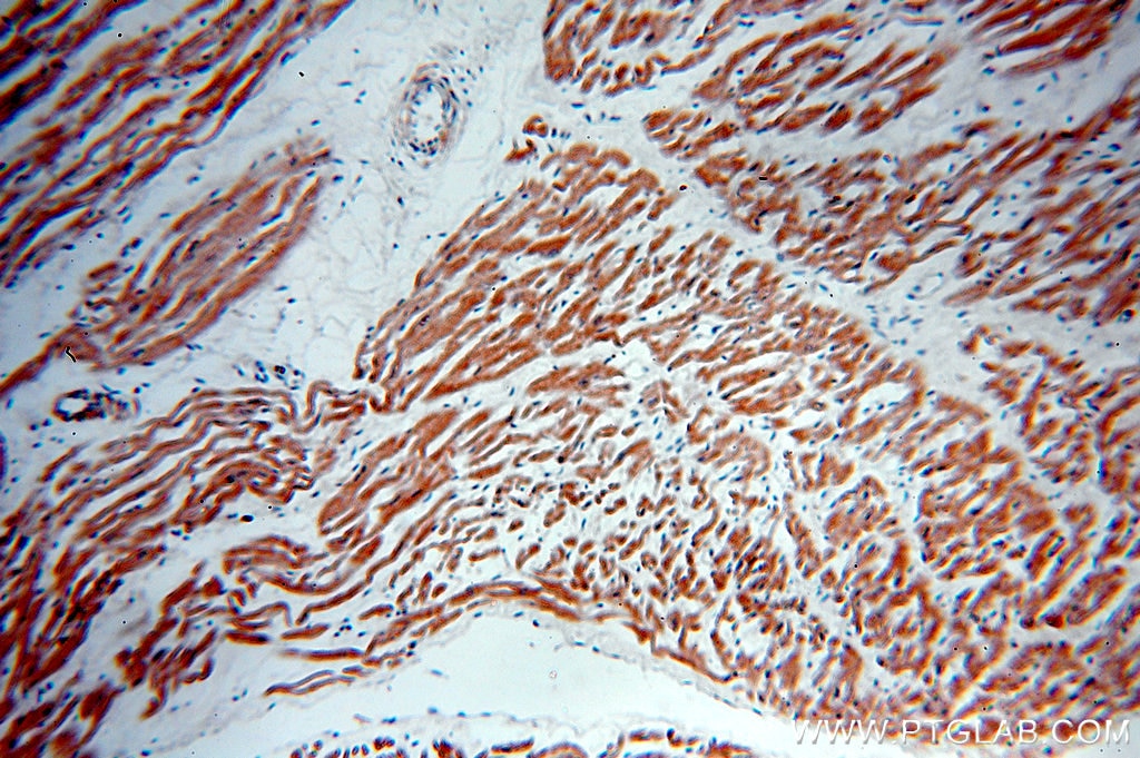 Immunohistochemistry (IHC) staining of human heart tissue using GABARAPL2-Specific Polyclonal antibody (18724-1-AP)