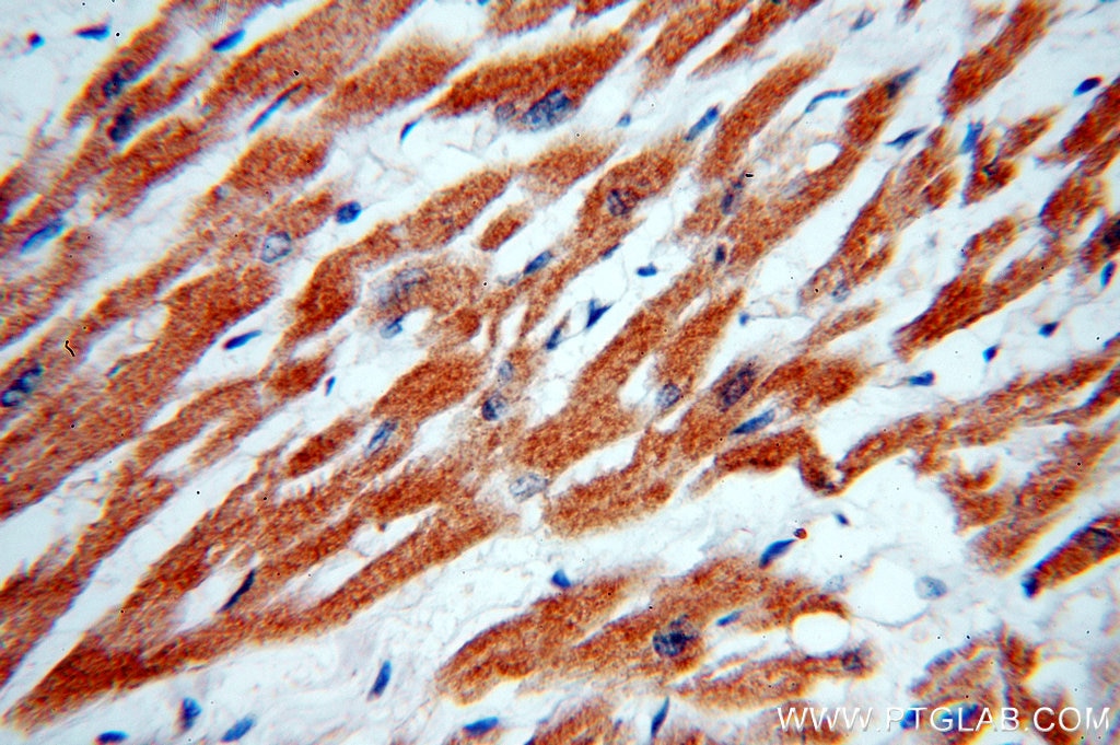 Immunohistochemistry (IHC) staining of human heart tissue using GABARAPL2-Specific Polyclonal antibody (18724-1-AP)