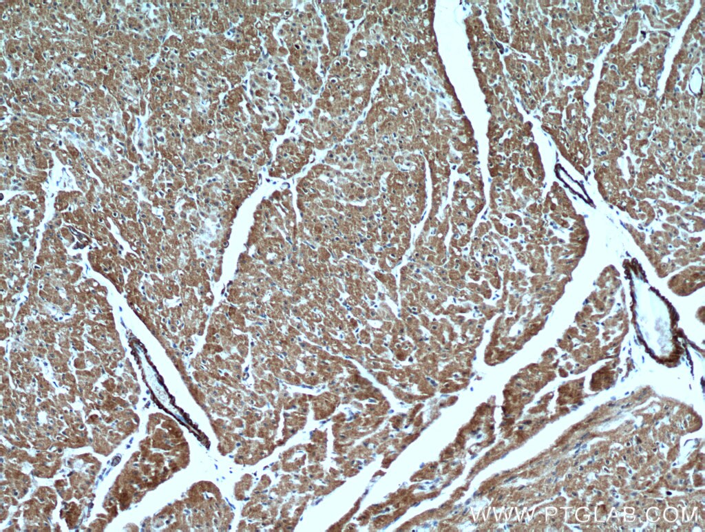 IHC staining of human heart using 18724-1-AP