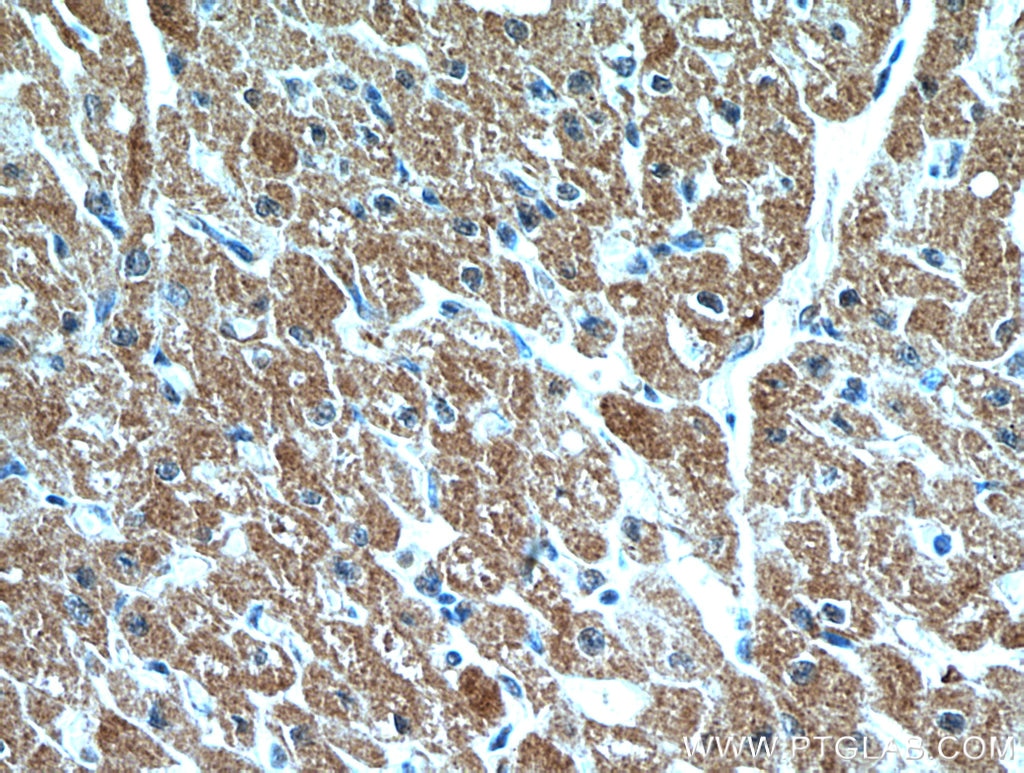 IHC staining of human heart using 18724-1-AP