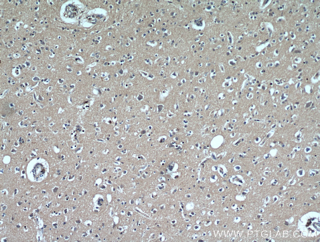 Immunohistochemistry (IHC) staining of human brain tissue using GABARAPL2-Specific Polyclonal antibody (18724-1-AP)