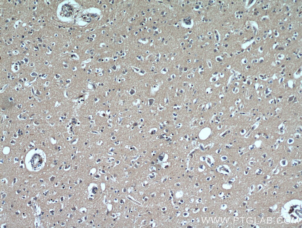 IHC staining of human brain using 18724-1-AP