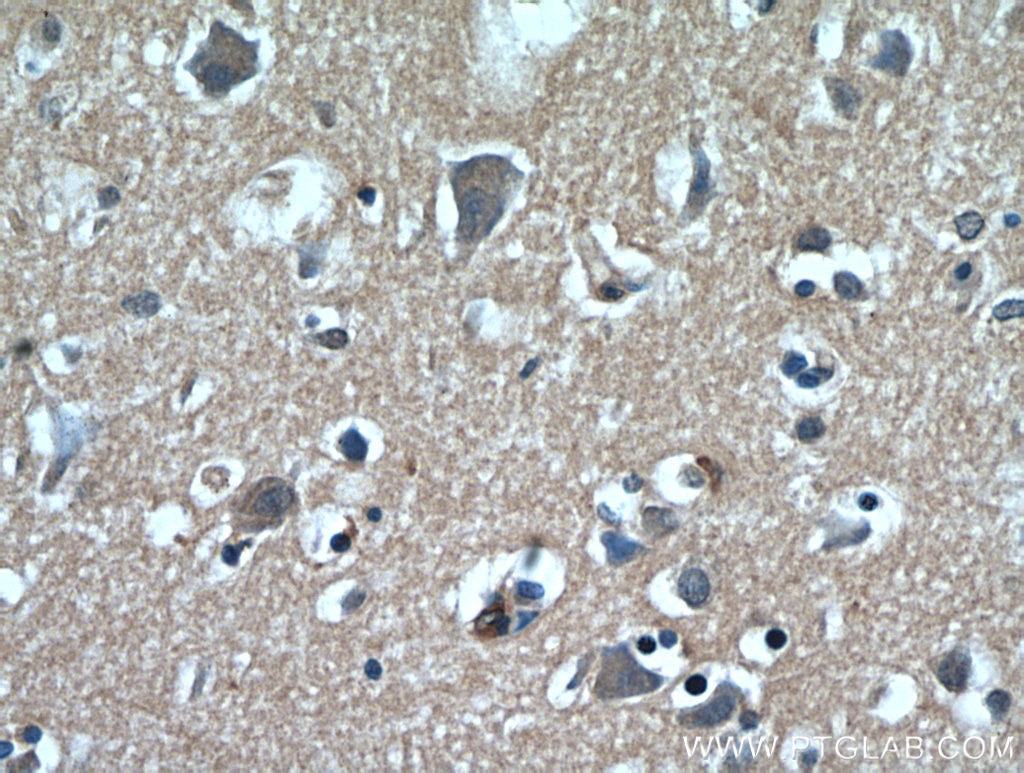 Immunohistochemistry (IHC) staining of human brain tissue using GABARAPL2-Specific Polyclonal antibody (18724-1-AP)