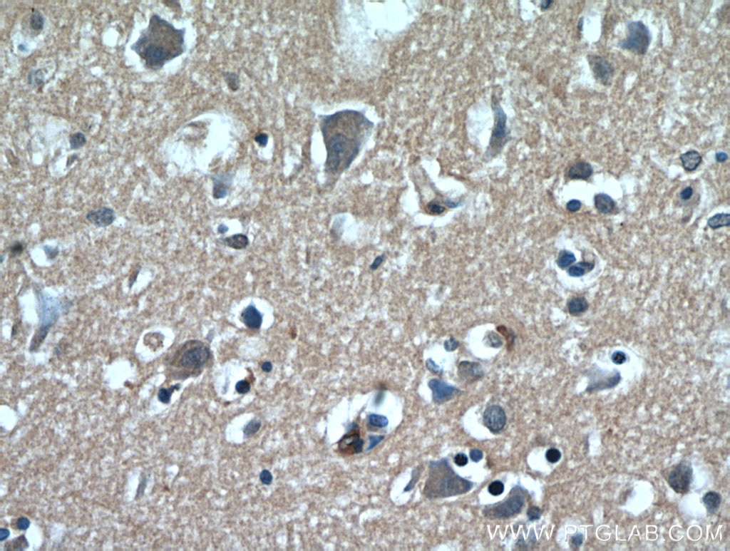 IHC staining of human brain using 18724-1-AP