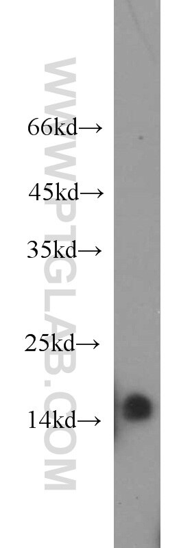 Western Blot (WB) analysis of human brain tissue using GABARAPL2-Specific Polyclonal antibody (18724-1-AP)