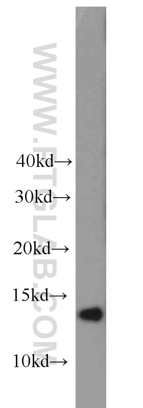 Western Blot (WB) analysis of COLO 320 cells using GABARAPL2-Specific Polyclonal antibody (18724-1-AP)