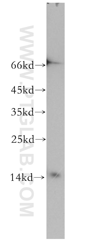 Western Blot (WB) analysis of mouse brain tissue using GABARAPL2-Specific Polyclonal antibody (18724-1-AP)